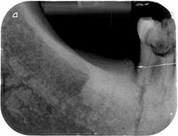 026865 037 20240827 1